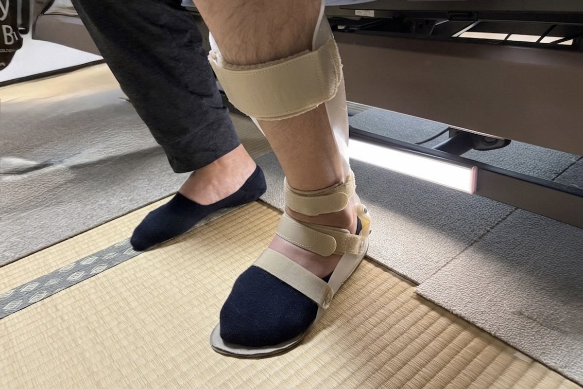 夏の装具と片麻痺 〜赤くなる足の原因は、たいていバンドにあります〜