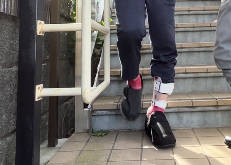脳卒中とは？運動障害との関係