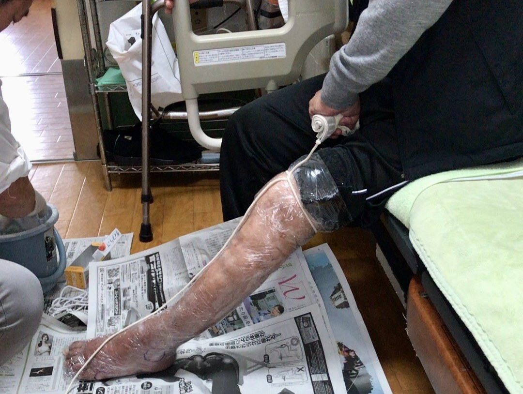 第3章:在宅リハビリの「見えにくい壁」 〜なぜパートナーは見直されないのか〜